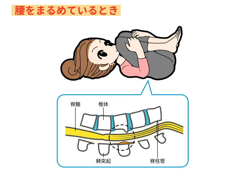 整体で脊柱管狭窄症の痛みやしびれは本当に治るのか？ | 松山市の整体