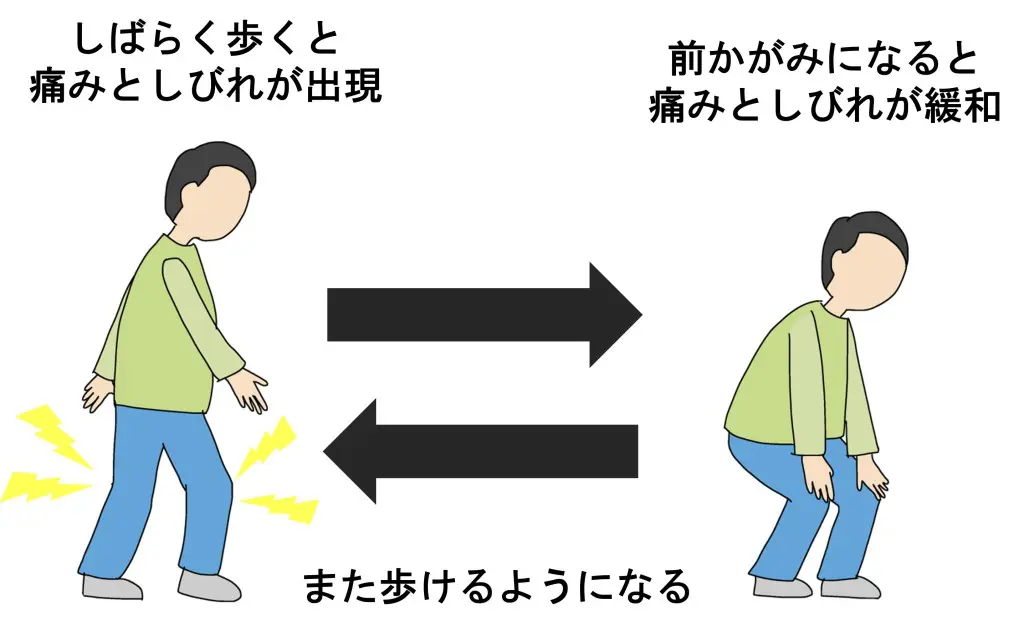 カイロプラクティック 整体 脊柱と骨盤の安定 足を診ることで